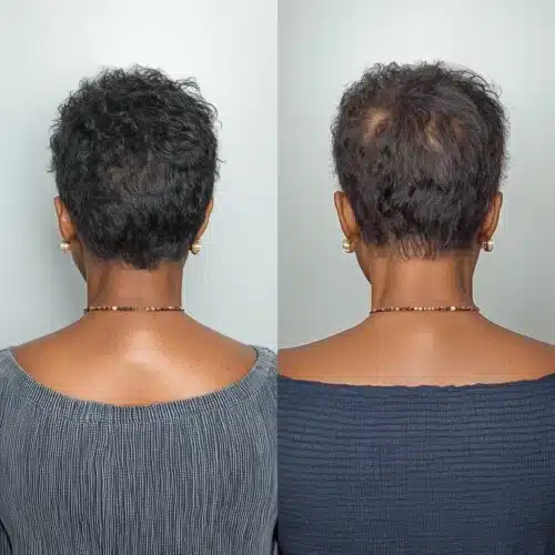 Follicle Activator ()