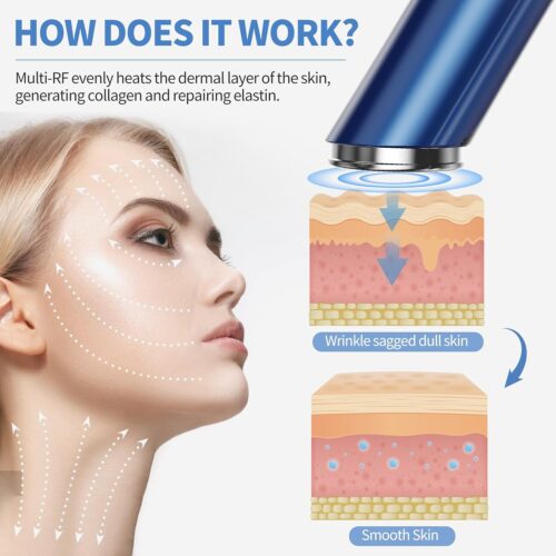 Neux Radiance Handset