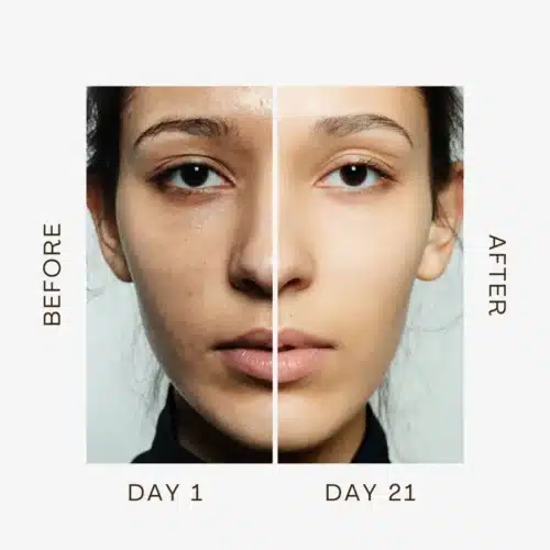 AgeDefy Radiance Wand