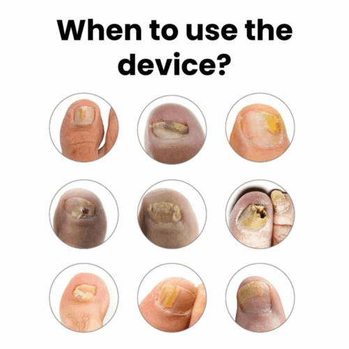 OrthoVital Device png